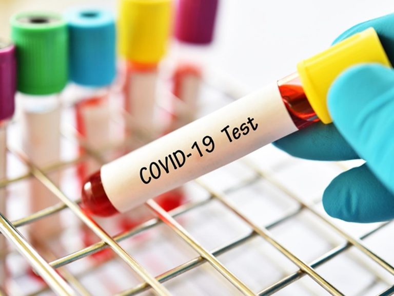 భయపెడుతున్న కరోనా… ఈ లక్షణాలున్నా పాజిటివ్ వస్తోందట…  