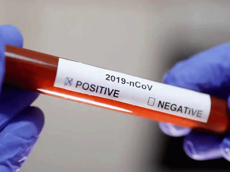 ఏపీలో మరిన్ని తగ్గిన కరోనా కేసులు..