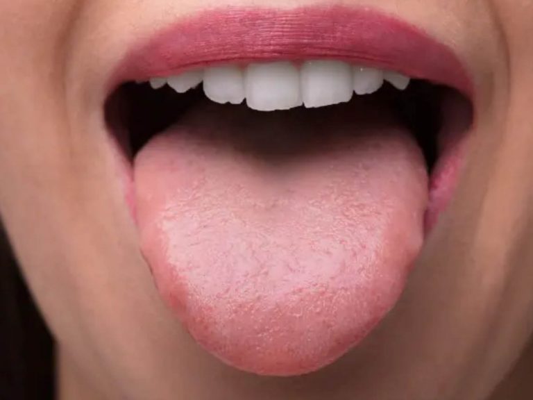 కరోనా గుర్తింపులో మరో కొత్త లక్షణం… 