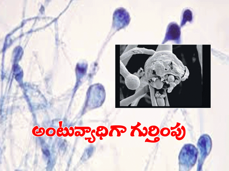 క‌ల‌వ‌ర‌పెడుతోన్న బ్లాక్ ఫంగ‌స్.. కేంద్రం కీల‌క నిర్ణ‌యం