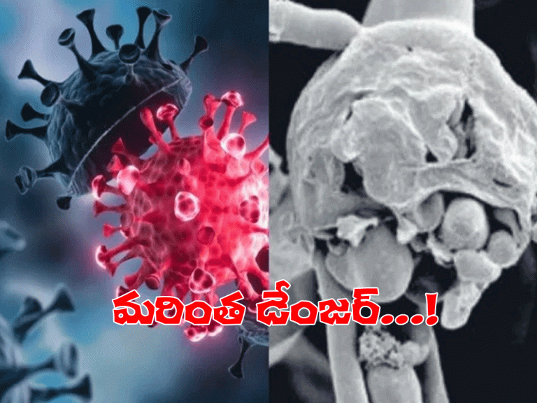 క‌ల‌క‌లం.. వెలుగులోకి వైట్ ఫంగ‌స్…!