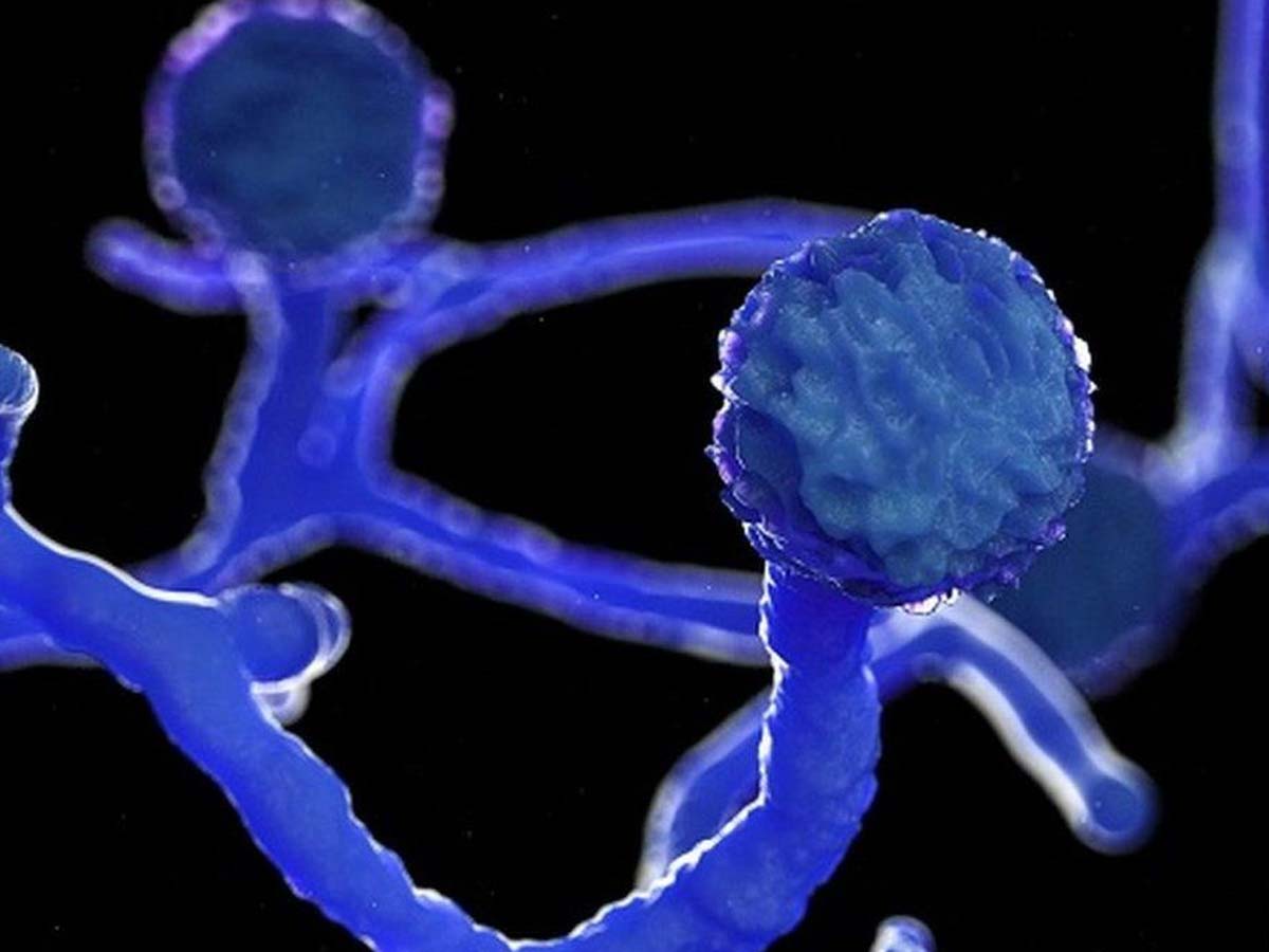 రాజన్న సన్నిధిలో బ్లాక్ ఫంగస్ కలకలం.. ఓ యువకుడు మృతి