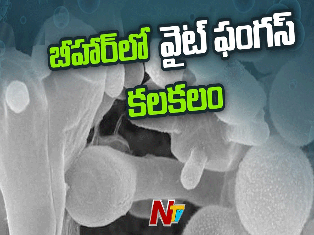 వైట్ ఫంగస్ లో కూడా కరోనా లక్షణాలు…