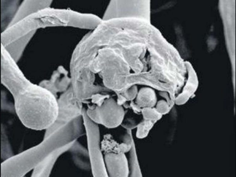 ఇండియాకు మరో టెన్షన్.. వైట్ ఫంగస్ కలకలం..!