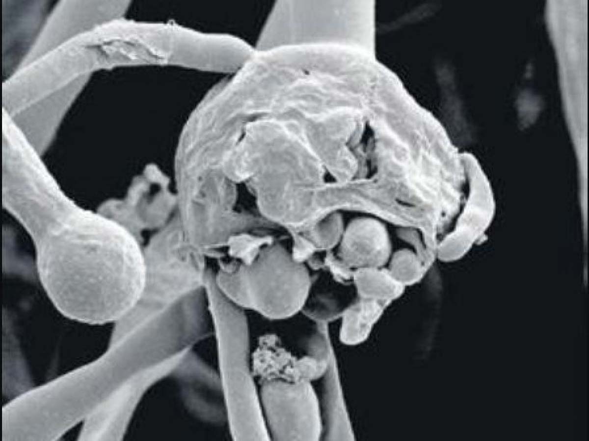 ఇండియాకు మరో టెన్షన్.. వైట్ ఫంగస్ కలకలం..!