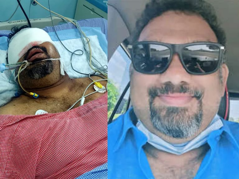 విషమంగానే కత్తి మహేష్ ఆరోగ్య పరిస్థితి!