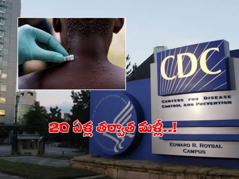 అమెరికాలో మరో వైరస్‌ కలకలం.. మంకీపాక్స్‌ కేసు వెలుగులోకి..