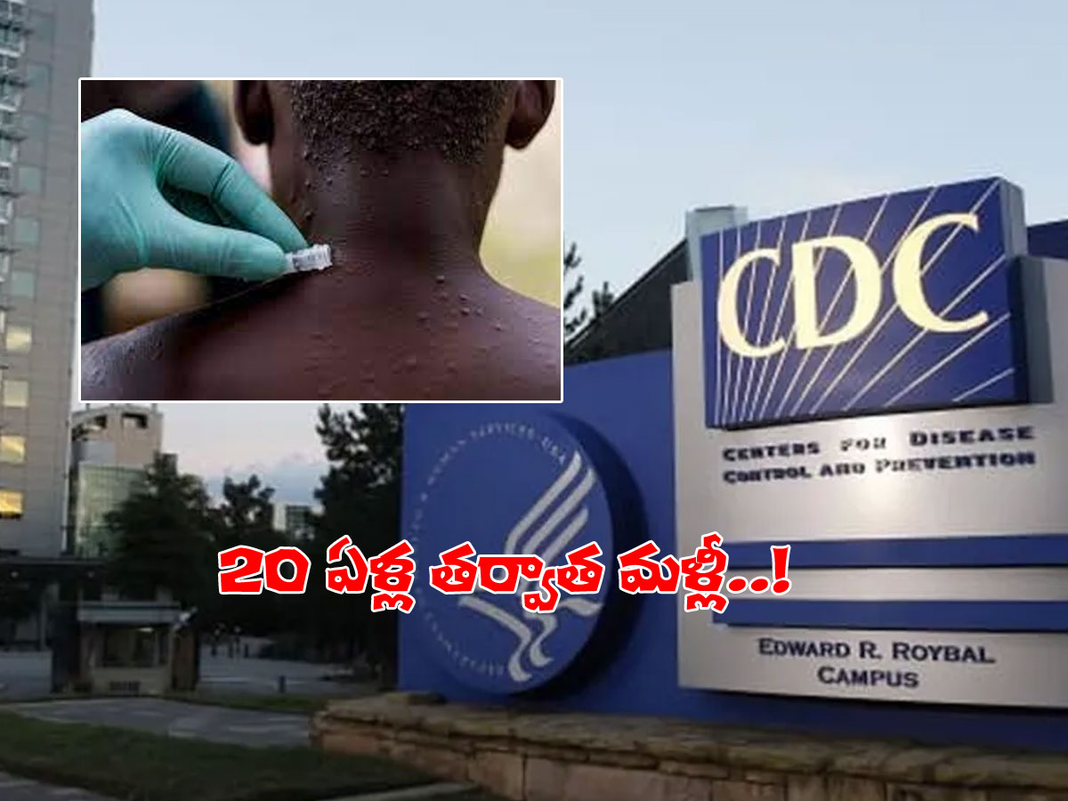 అమెరికాలో మరో వైరస్‌ కలకలం.. మంకీపాక్స్‌ కేసు వెలుగులోకి..