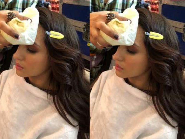 షూటింగ్ లో గాయపడ్డ నటి