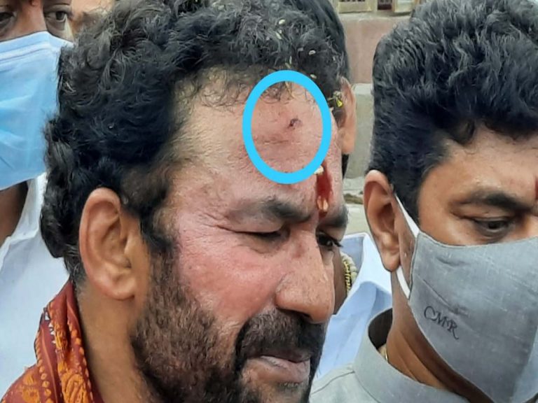 కేంద్ర‌మంత్రి కిష‌న్ రెడ్డి త‌ల‌కు గాయం… కార‌ణం…