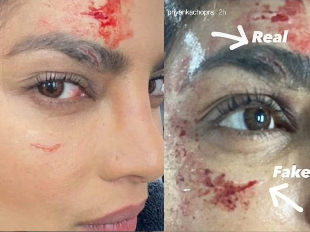 Priyanka Chopra Injured on Citadel Movie Shooting