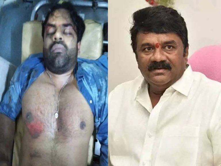 సాయి ధరమ్ తేజ్ ఆరోగ్యంపై మంత్రి తలసాని ఆరా