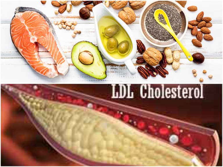 ఇలా చేస్తే చెడు కొలెస్ట్రాల్ దూరం..!