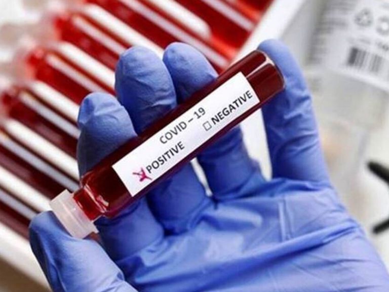 నేడు భారత్ లో భారీగా తగ్గిన కరోనా కేసులు…