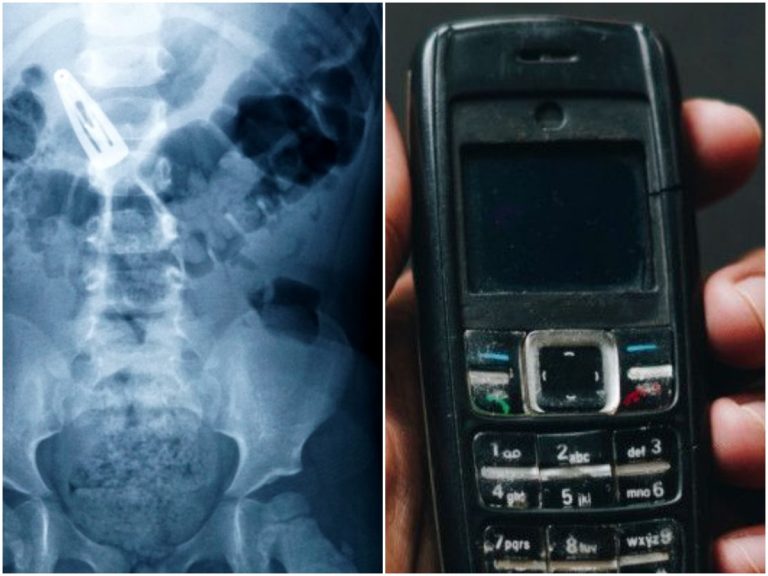 ఫోన్ మొత్తం మింగేశాడు.. తర్వాత ఏమైందో తెలుసా?