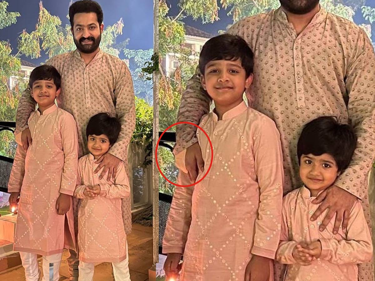 బ్రేకింగ్:ఎన్టీఆర్ కుడి చేతికి సర్జరీ..