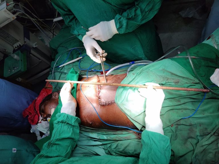 తిరుపతి స్విమ్స్ ఆస్పత్రిలో అరుదైన సర్జరీ విజయవంతం