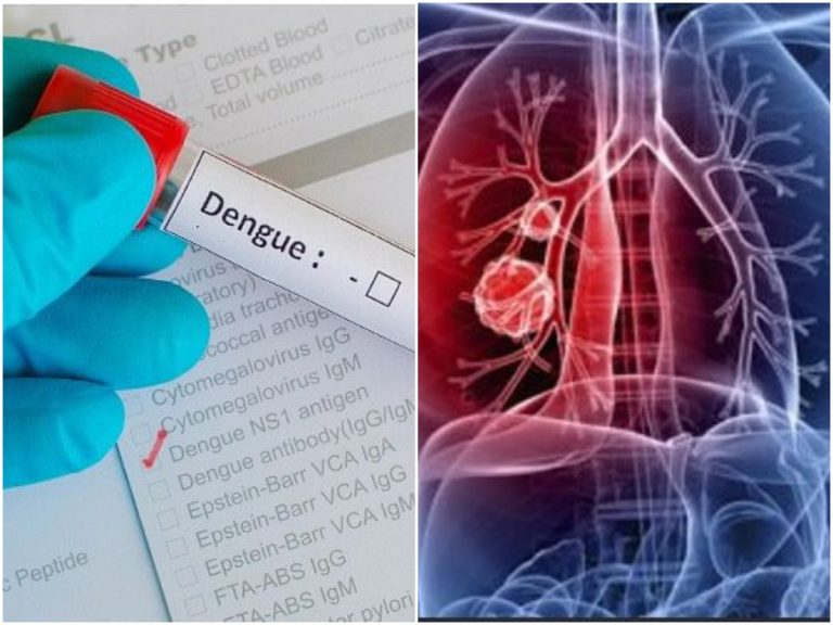 త్వరలో అందుబాటులోకి డెంగ్యూ, టీబీకి వ్యాక్సిన్లు