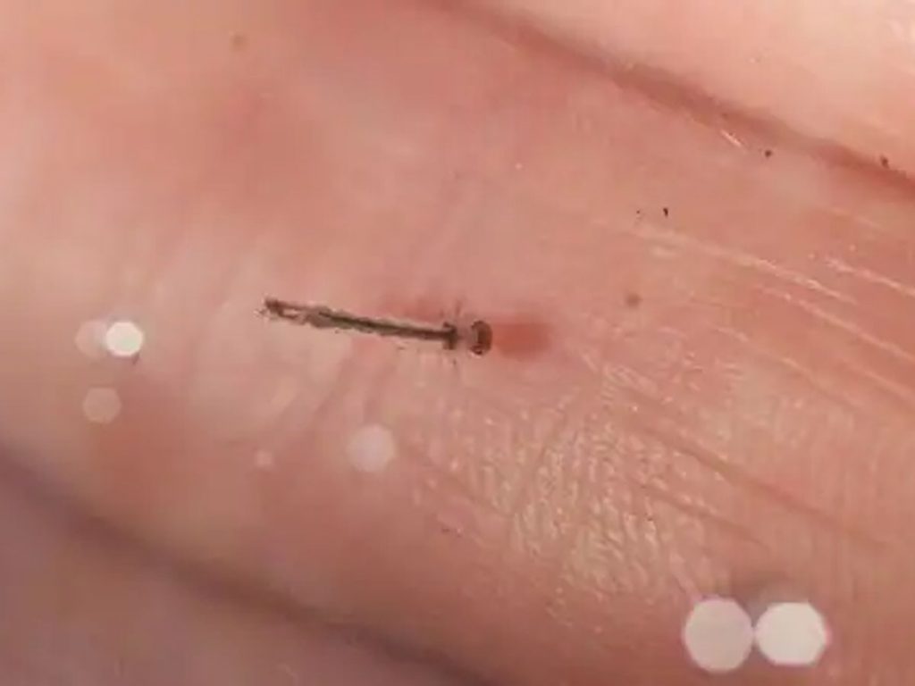 zika virus