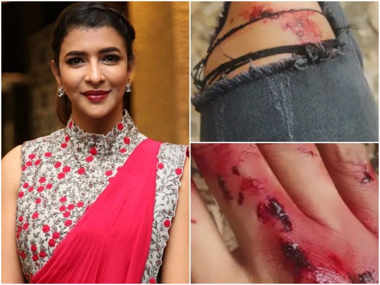 నటి మంచు లక్ష్మీకి యాక్సిడెంట్.. అసలు ఏమైంది?