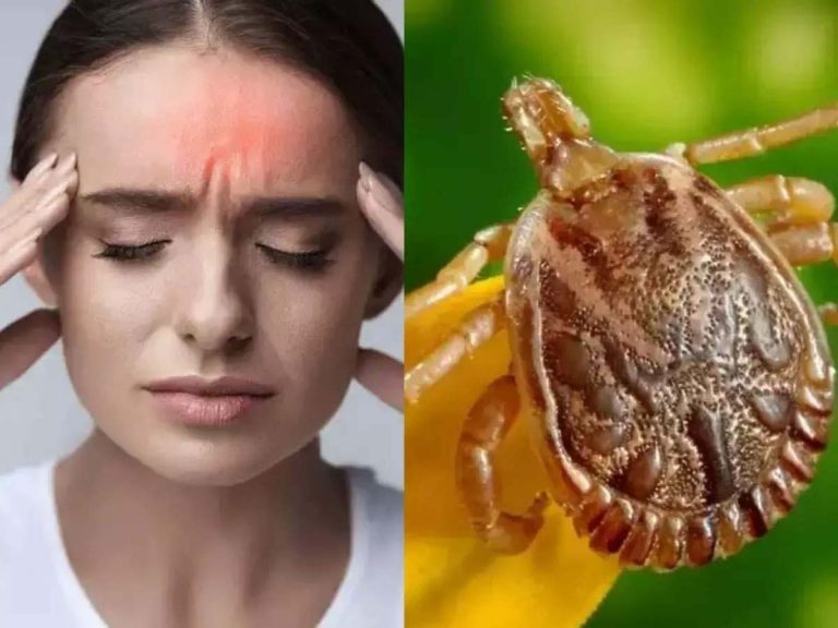 తెలంగాణలో కొత్త వ్యాధి..లక్షణాలు ఇవే