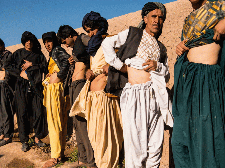 ఘోరం: తినడానికి డబ్బులు లేక కిడ్నీలు అమ్ముకొంటున్నారట