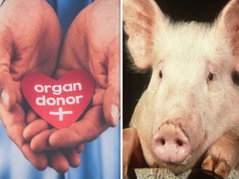 పంది గుండెతో మొదటి ప్రయోగం మనవాడిదే… కానీ!