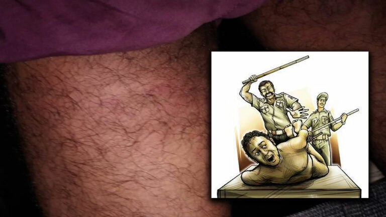 Sangareddy: పుల్కల్ ఎస్సై గణేష్ దౌర్జన్యం.. ఆలస్యంగా వచ్చాడని..