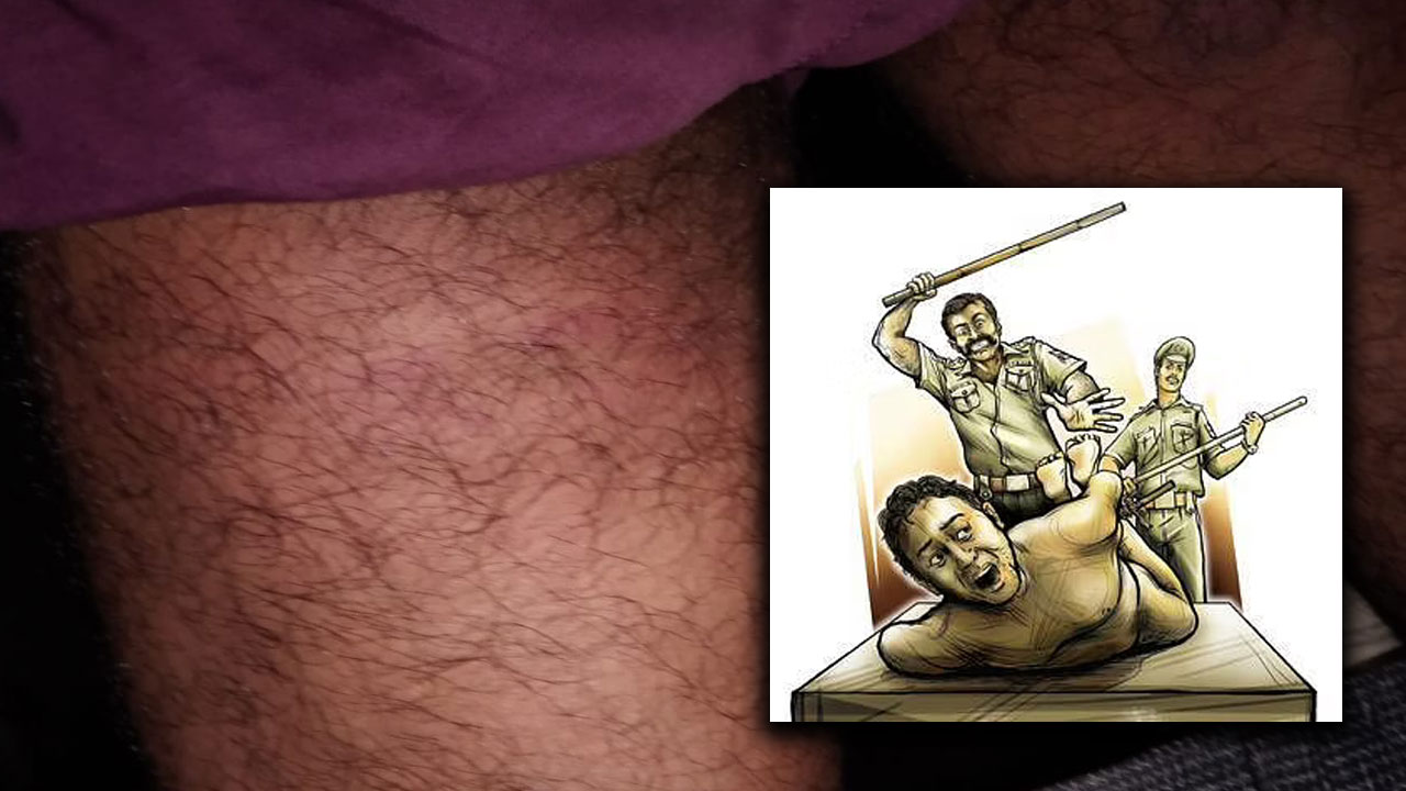 Sangareddy: పుల్కల్ ఎస్సై గణేష్ దౌర్జన్యం.. ఆలస్యంగా వచ్చాడని..