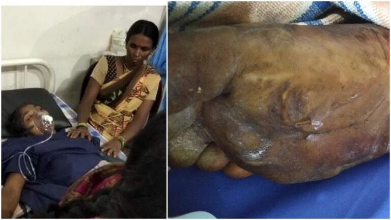 Fake Baba: దొంగ బాబా నిర్వాకం.. నిప్పులపై యువతి 2 కాళ్లు