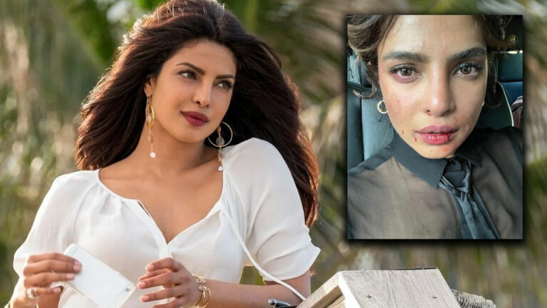 Priyanka Chopra: ముఖంపై ఆ రక్తపు మరకలేంటి?