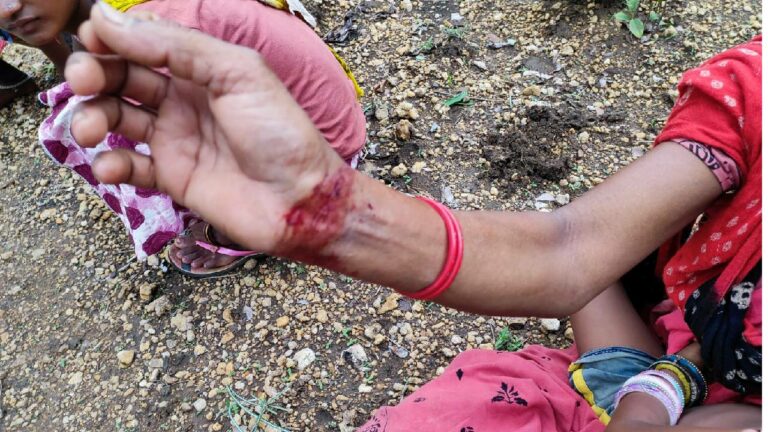 Bhadradri Kothagudem: గిరిజన మహిళలపై ఫారెస్ట్ అధికారుల దాడులు