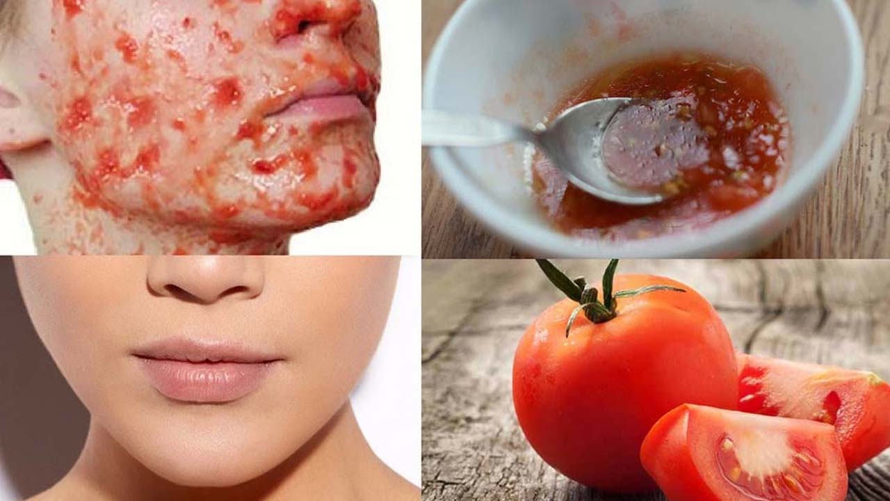 Health Tips: ఎండవల్ల వచ్చే నలుపు పోవాలంటే.. ఈ చిట్కా ఉపయోగించండి