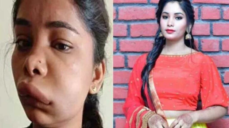 Swathi Sathish: వికటించిన సర్జరీ.. నటి ముఖం మొత్తం..