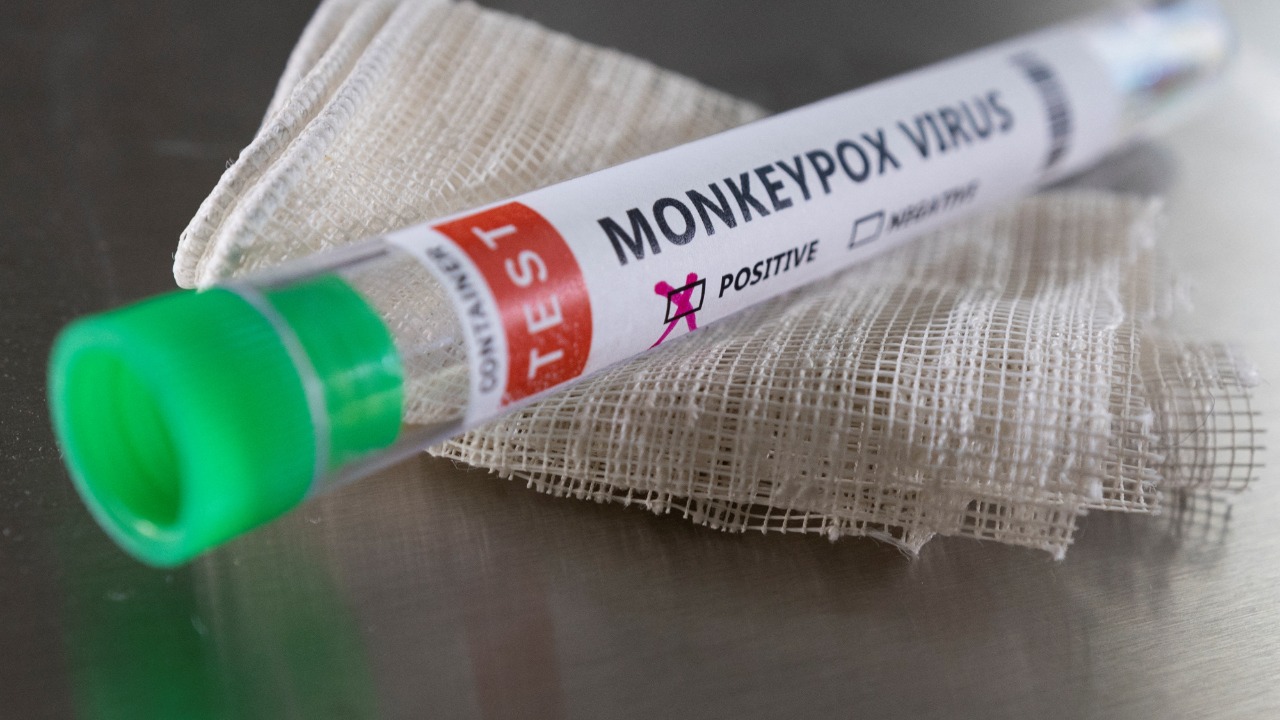 Monkeypox: India monkeypox virus different from European type