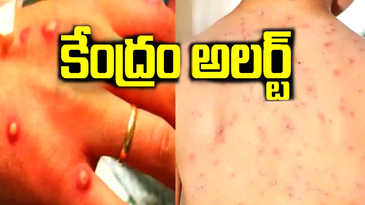 Monkeypox: కేంద్రం అలర్ట్‌.. రంగంలోకి టాస్క్‌ఫోర్స్‌..!