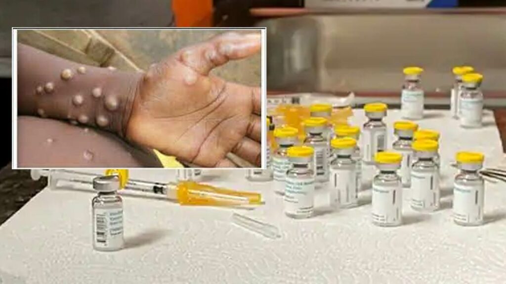 Monkeypox Vaccine