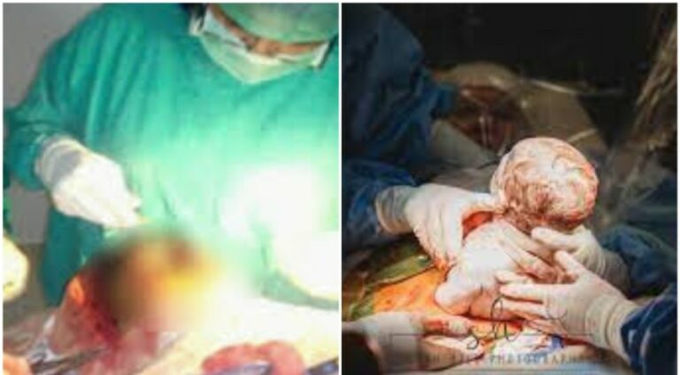 Torch Light Delivery:టార్చిలైట్ వెలుగులో డెలివరీ.. ఎక్కడంటే?