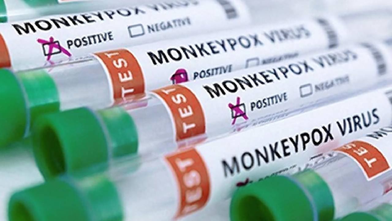 Monkeypox: Center's key decision.. Invitation of tenders for vaccine development