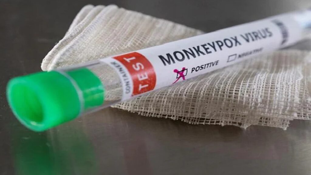 Monkeypox Virus