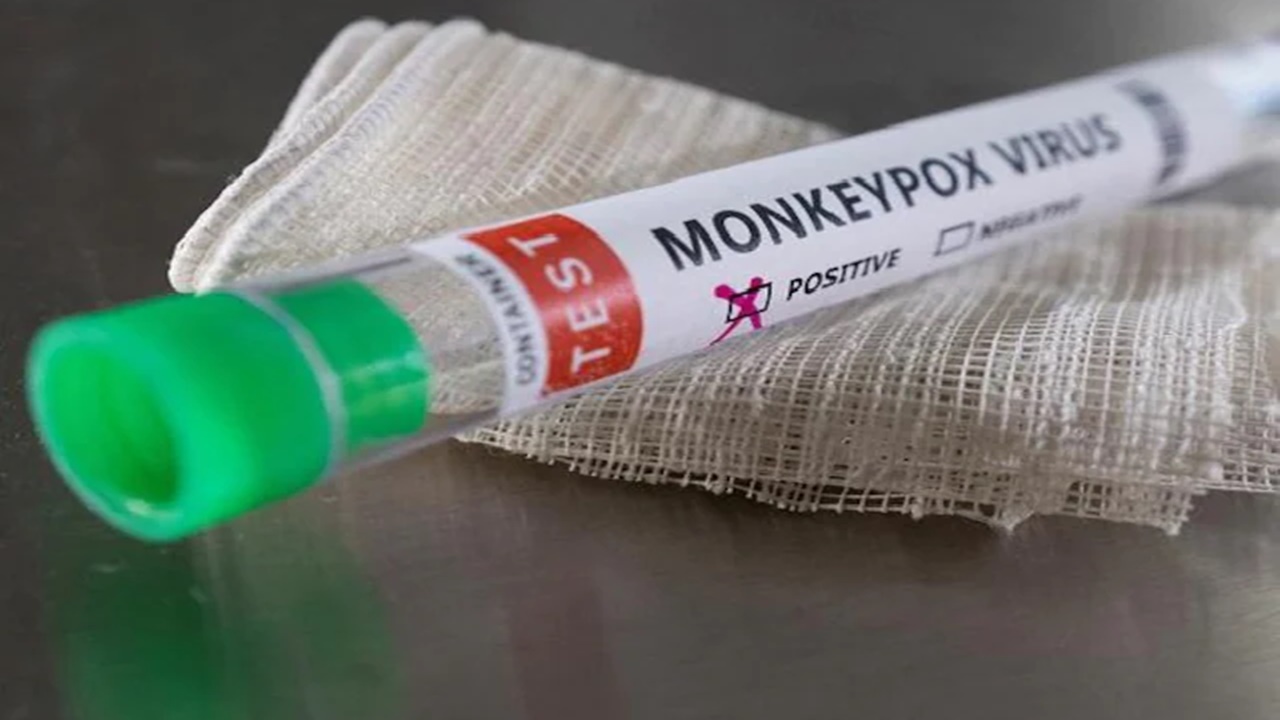 Monkeypox: A 22-year-old man died of monkeypox in Kerala.. The first death in the country