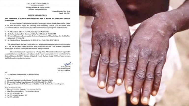 Monkey Pox: దేశంలో తొలికేసు.. నేటి నుంచి నగరంలో మంకీ పాక్స్‌ టెస్టులు