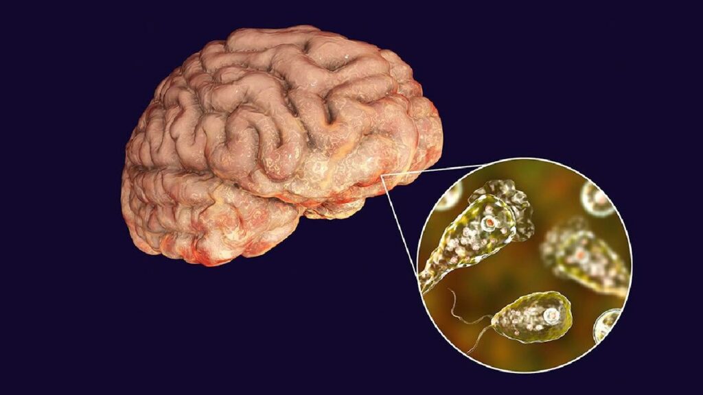 Brain Eating Amoeba