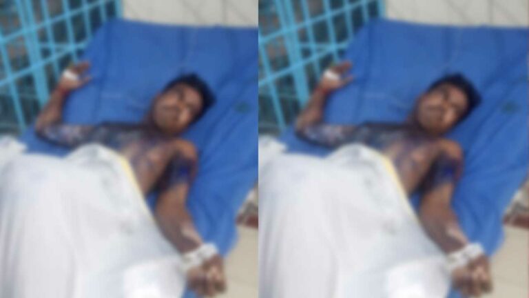 Crime: ఆ పనిచేస్తున్నాడని భర్త మర్మాంగంపై దాడి చేసిన భార్య.. దాన్ని పోసి