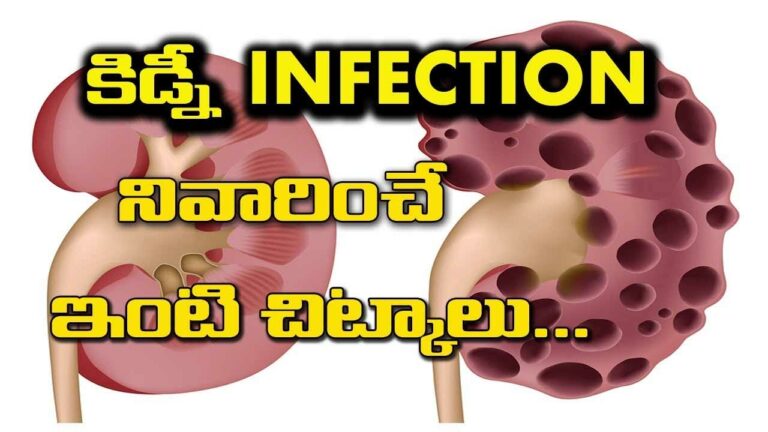 Kidney Infection : కిడ్నీ ఇన్ఫెక్షన్‌ నివారించే ఇంటి చిట్కాలు