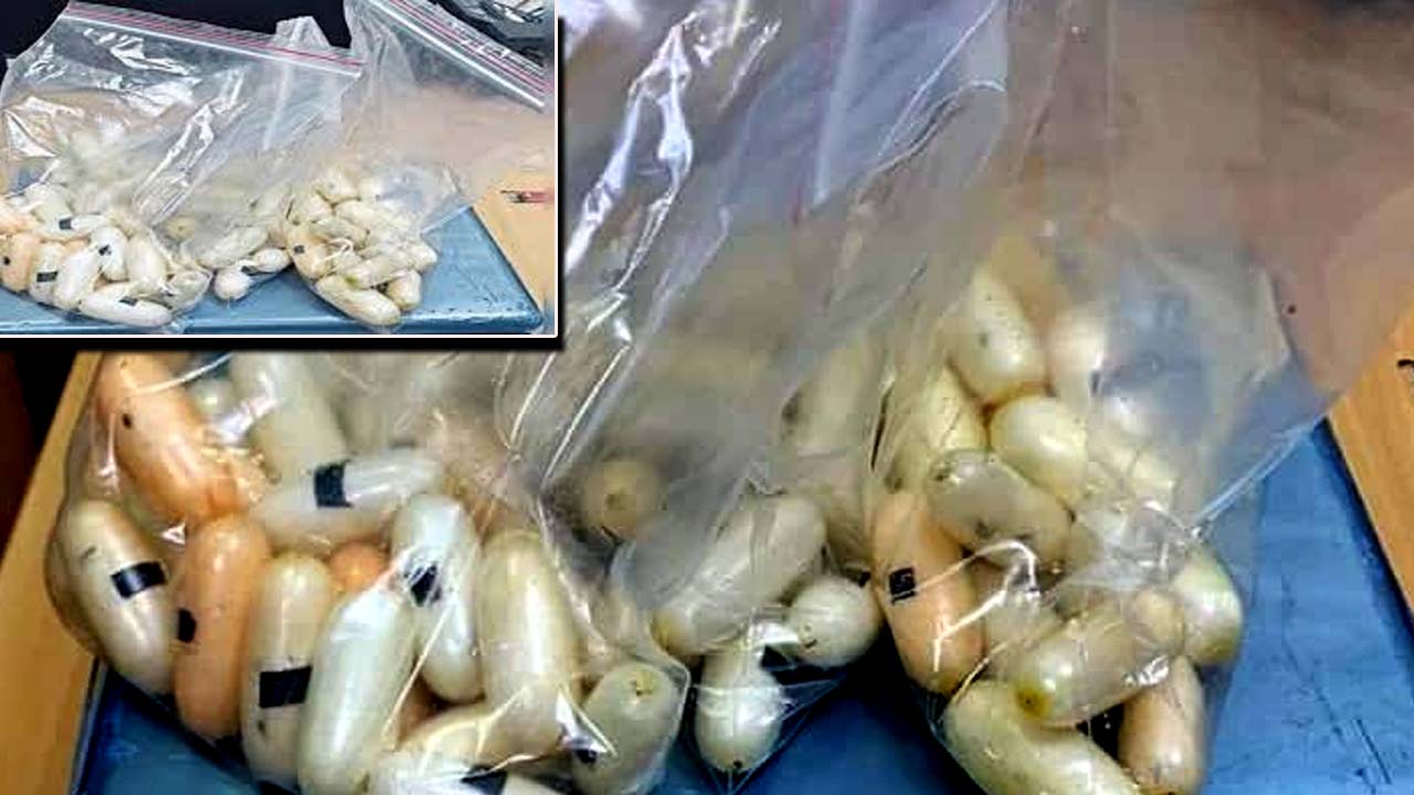 Bangalore Airport: కడుపులో 104 క్యాప్సిల్స్..  షాక్ అయిన కస్టమ్స్