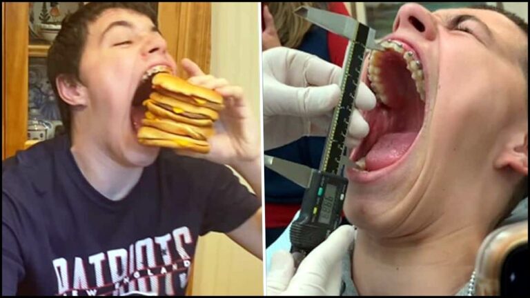 Isaac Johnson Mouth: నోరు తెరిచాడు.. గిన్నిస్ బుక్ రికార్డులకెక్కాడు