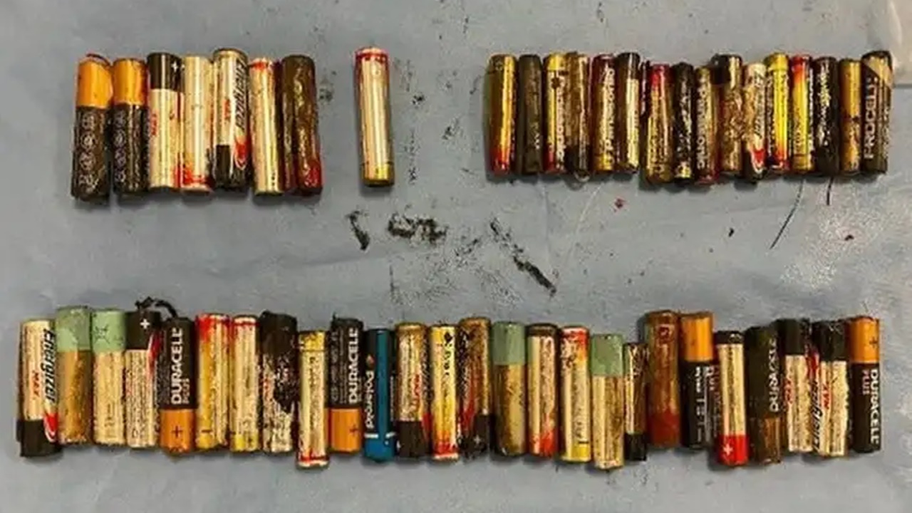 Ireland Old Woman: 55 బ్యాటరీలను మింగి.. డాక్టర్లకే చెమటలు పట్టించిన 66 ఏళ్ల వృద్ధురాలు