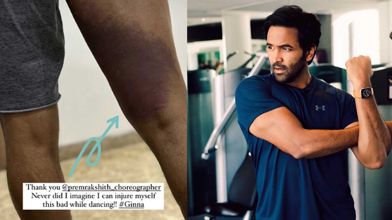 Manchu Vishnu: షాకింగ్.. ‘మా’ ప్రెసిడెంట్ కు గాయాలు.. అంతా అతనివలనే