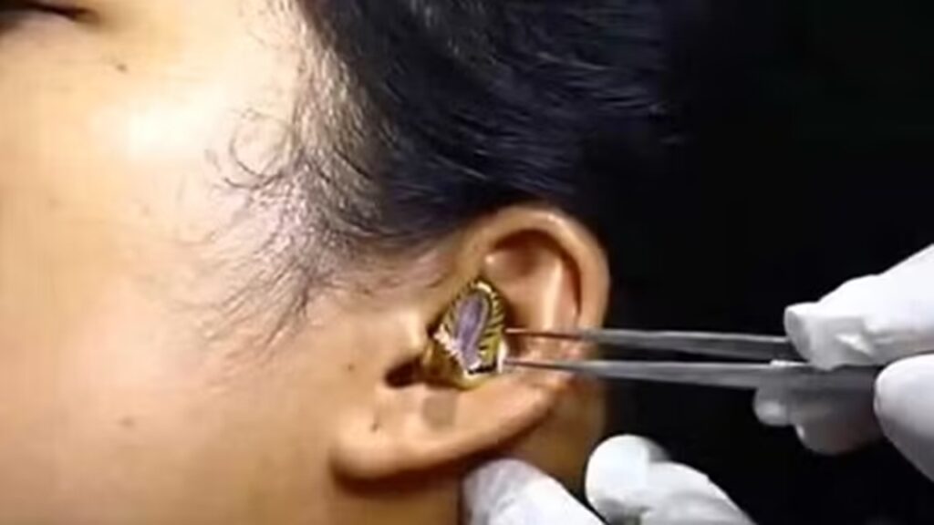 Snake In Woman Ear